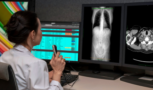 Building Smarter Radiology Workflows with Flexible Imaging Solutions