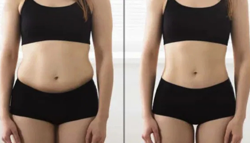 A Practical Guide to Safe and Effective Body Contouring