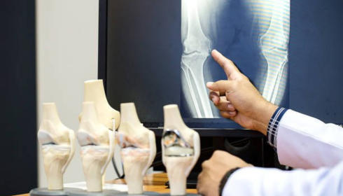 A Practical Guide to Choosing an Orthopaedic Hospital in Bangalore
